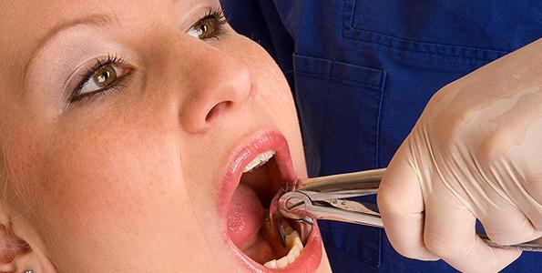 bezbolestná extrakce zubů