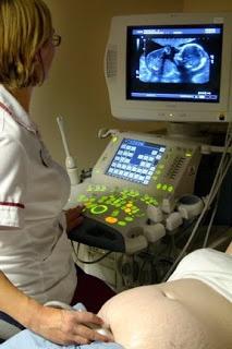 Dopler ultrazvuk těhotných žen