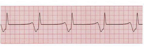 cardiologi allapinina recensioni