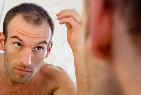 finasteride per i capelli recensioni uomini