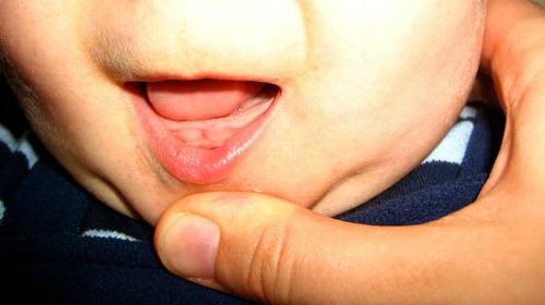 calgel recenzje podczas ząbkowania