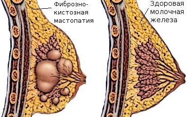 pregled i primjena mammoleptina