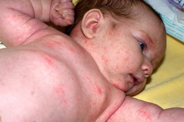 miscela per la tosse secca per bambini sotto 1 anno