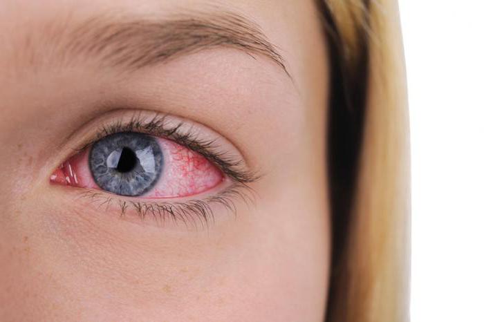 povzroča rdečina in suhost očesa ter zdravljenje