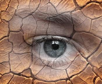 suchá kůže kolem očí způsobuje a léčbu
