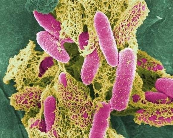 E. coli v urinu