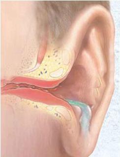 příznaky onemocnění lidského ucha