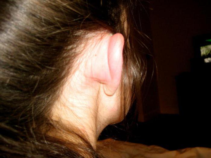 lobi delle orecchie gonfiati