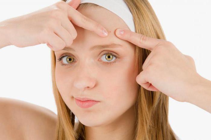Come rimuovere l'acne dalla faccia dei metodi popolari