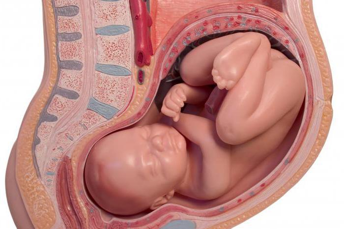 Bilirubina sollevata del neonato