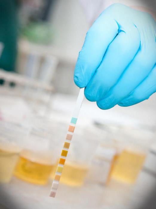 analiza urina povečala beljakovine
