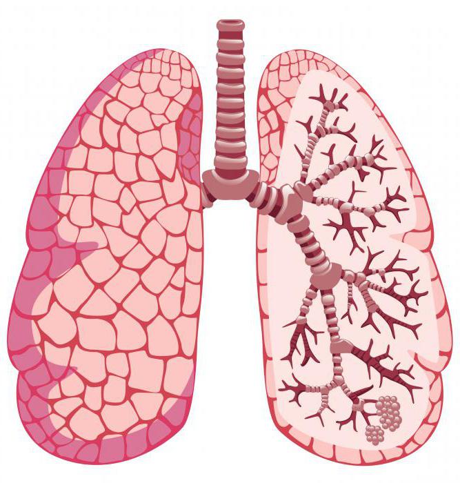 nujna prva pomoč v primeru astme