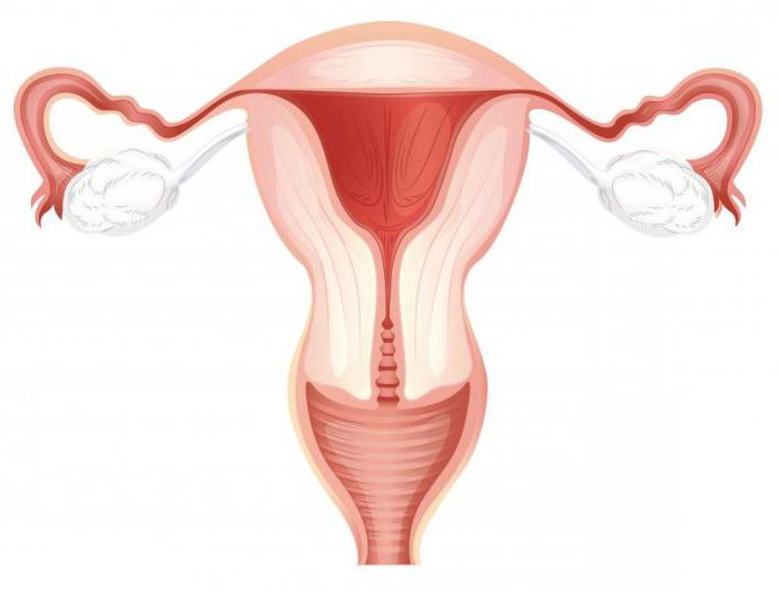 curettage dell'iperplasia dell'endometrio