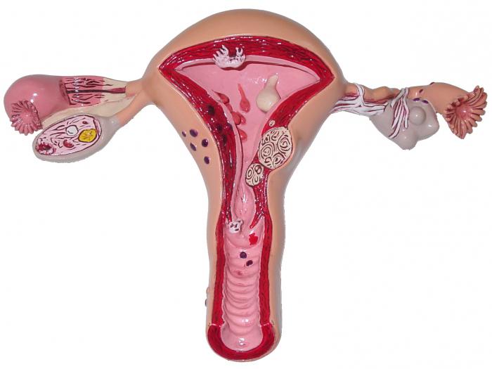 odstranění endometria