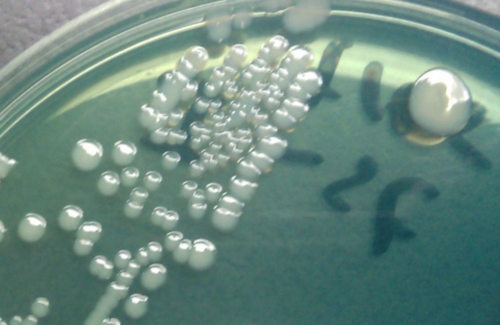 Reprodukce bakterií v živném médiu