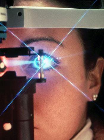 Pregledi laserskih laskov