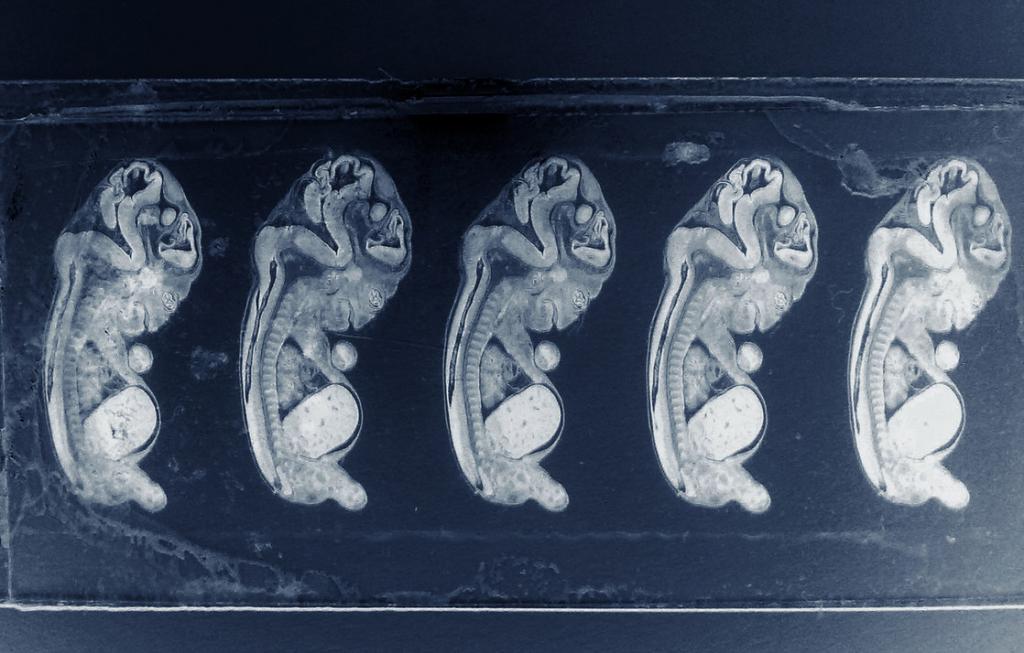 Foto di embrioni umani
