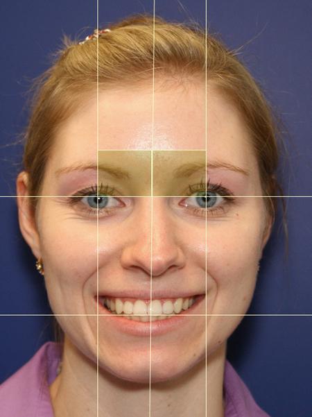 Trattamento di asimmetria facciale