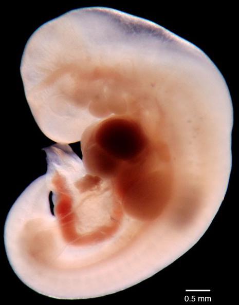 fetální vývoj v týdnu těhotenství