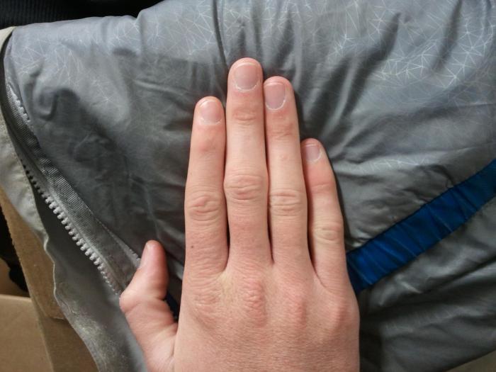 средният пръст на дясната ръка е вцепенен
