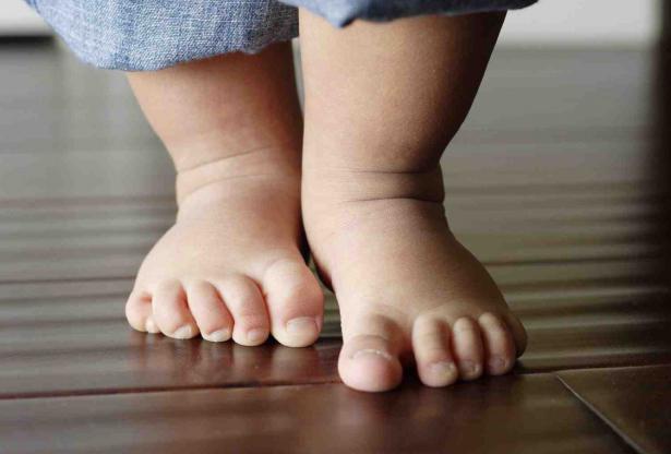 Ploskalgalgusnaya deformace nohou u dětí
