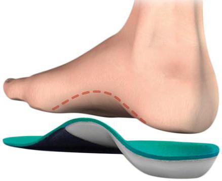 prevencija plosnatog stopala