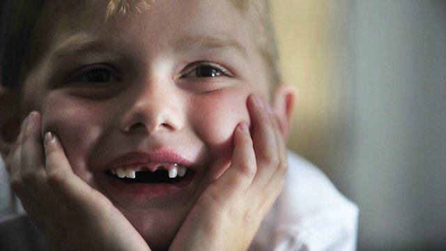 fluoridace zubů u dětí