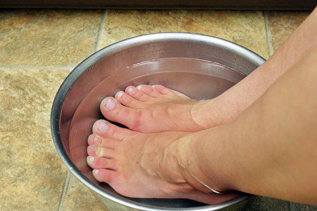 trattamento piedi ipercheratosi