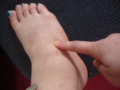 ból w górnej części stopy