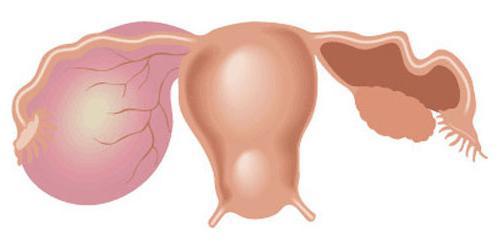 velikost funkční ovariální cysty