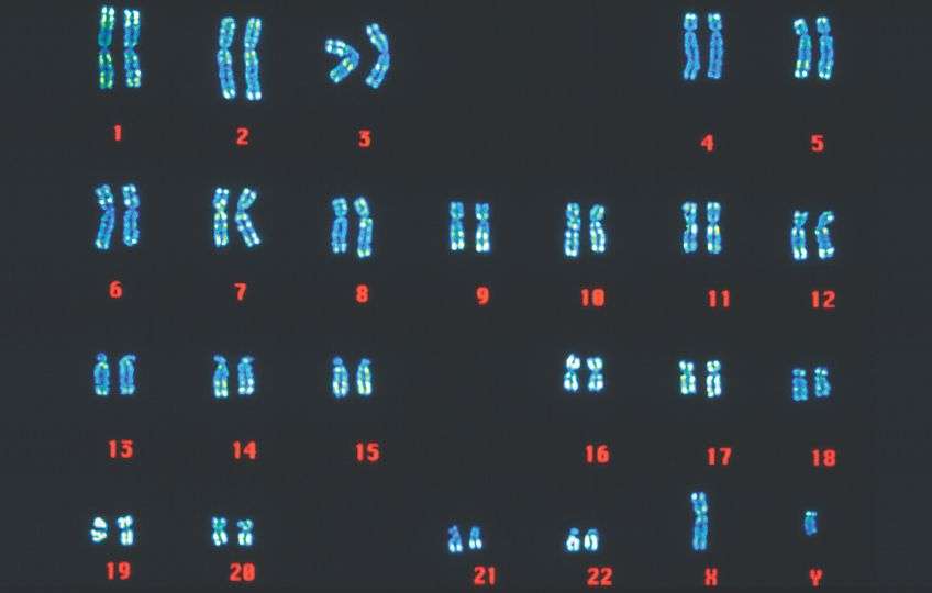 Set cromosoma umano (maschio)