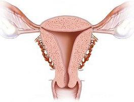 glandulární cystickou hyperplázií léčby endometriem