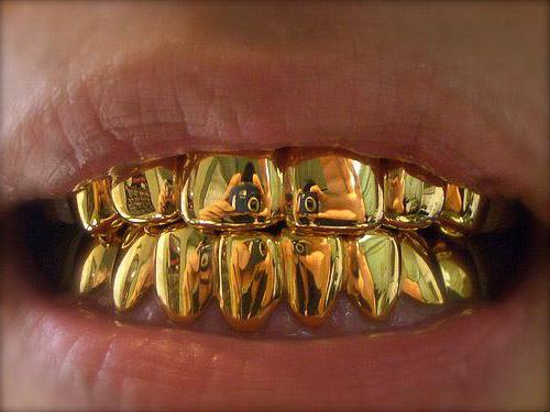 foto di denti d'oro