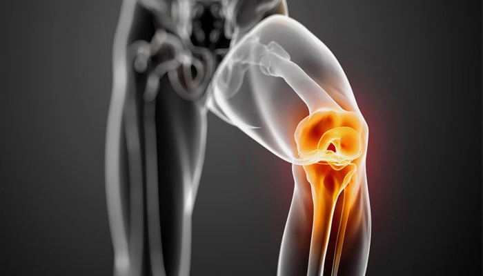 fizioterapeutski tretman zgloba koljena