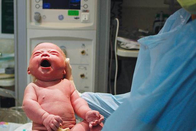 Grški sindrom pri novorojenčkih
