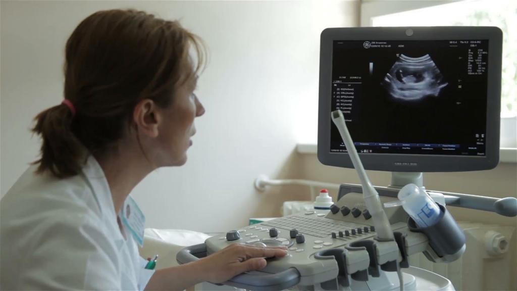 ginekološki ultrazvuk