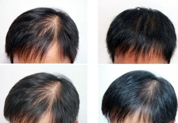 преглед на спрея за растеж на косата