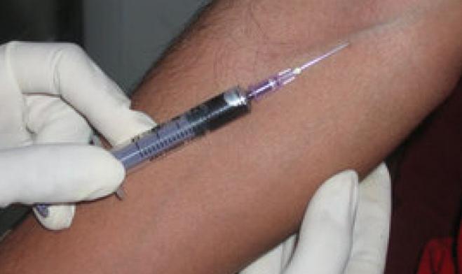 Krevní test HBsAg - normální