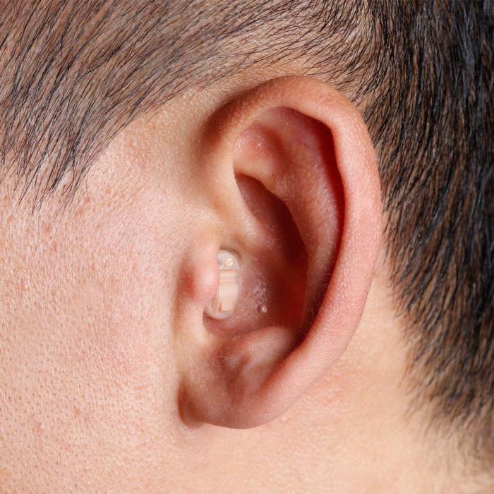 slušni pripomočki za uho pregledujejo cene