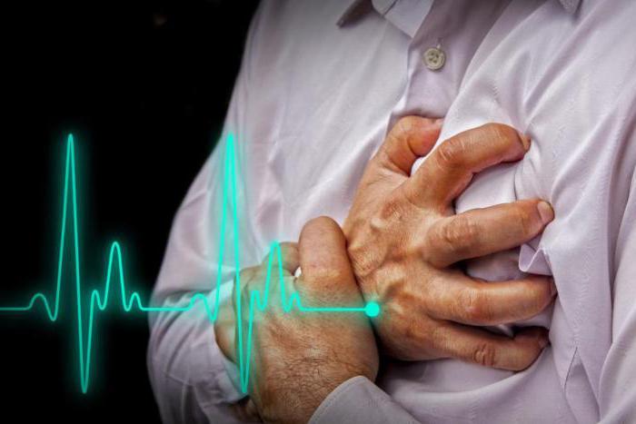diagnoza srčnih okvar