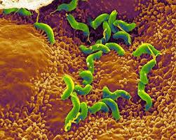 Příznaky Helicobacter pylori