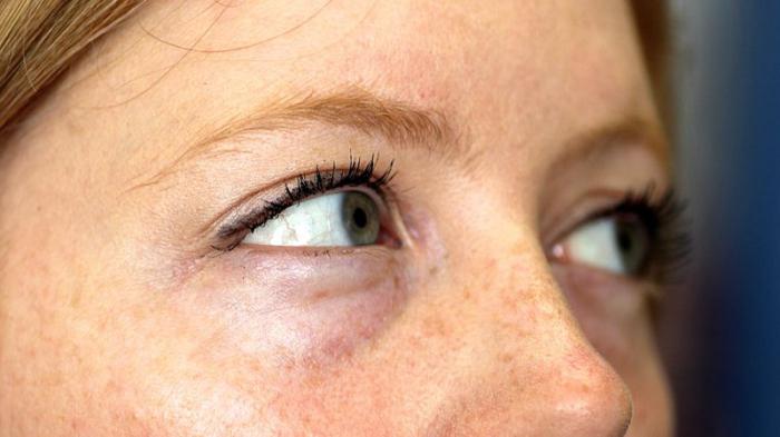 heparin oční masť