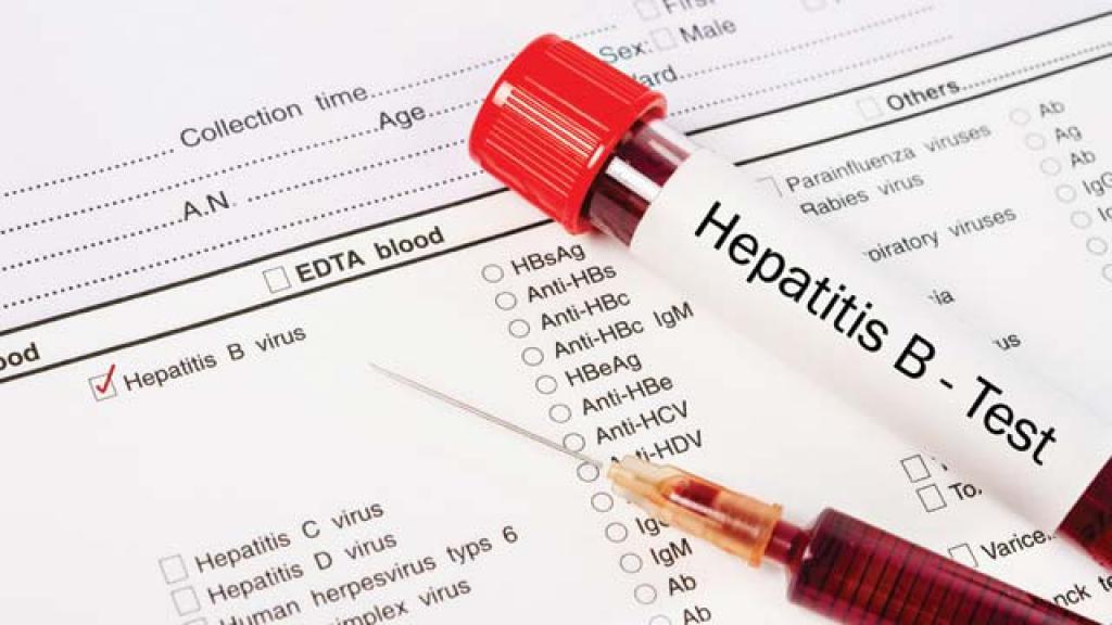 virus hepatitidy b
