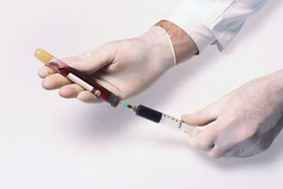 krevní test na hepatitidu
