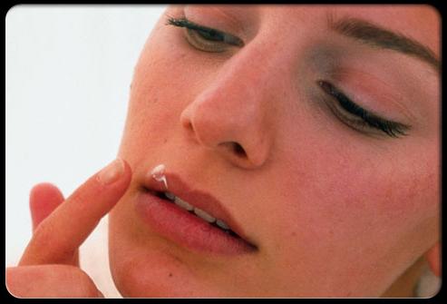 opryszczka w nosie, jak leczyć