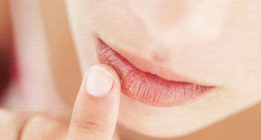 liječiti herpes na usnama