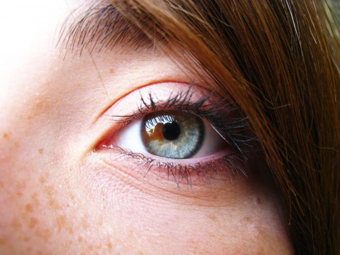 delna očesna heterohromija