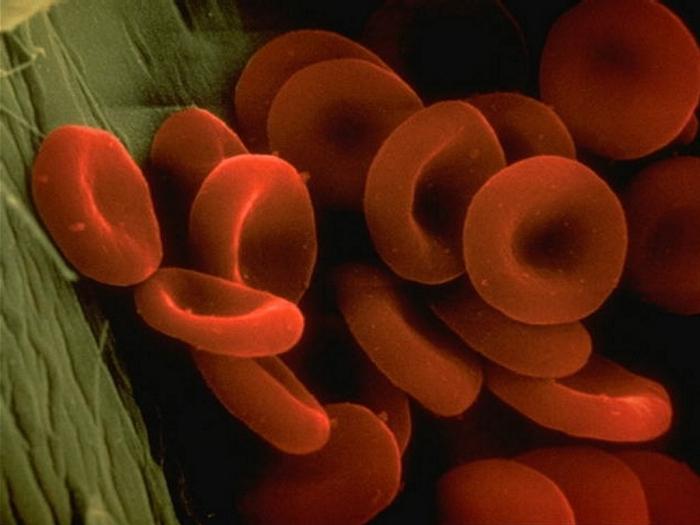 wysokie przyczyny hemoglobiny