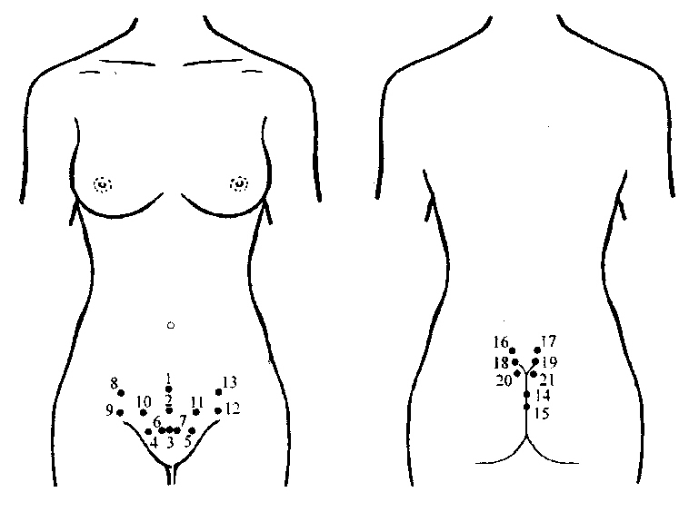 Pokazuje pijavice u ginekologiji