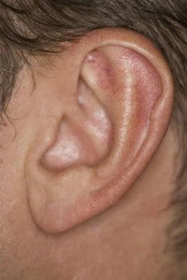 il brufolo nell'orecchio fa male